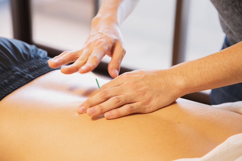 Advanced hair transplant techniques available at clinics in Istanbul