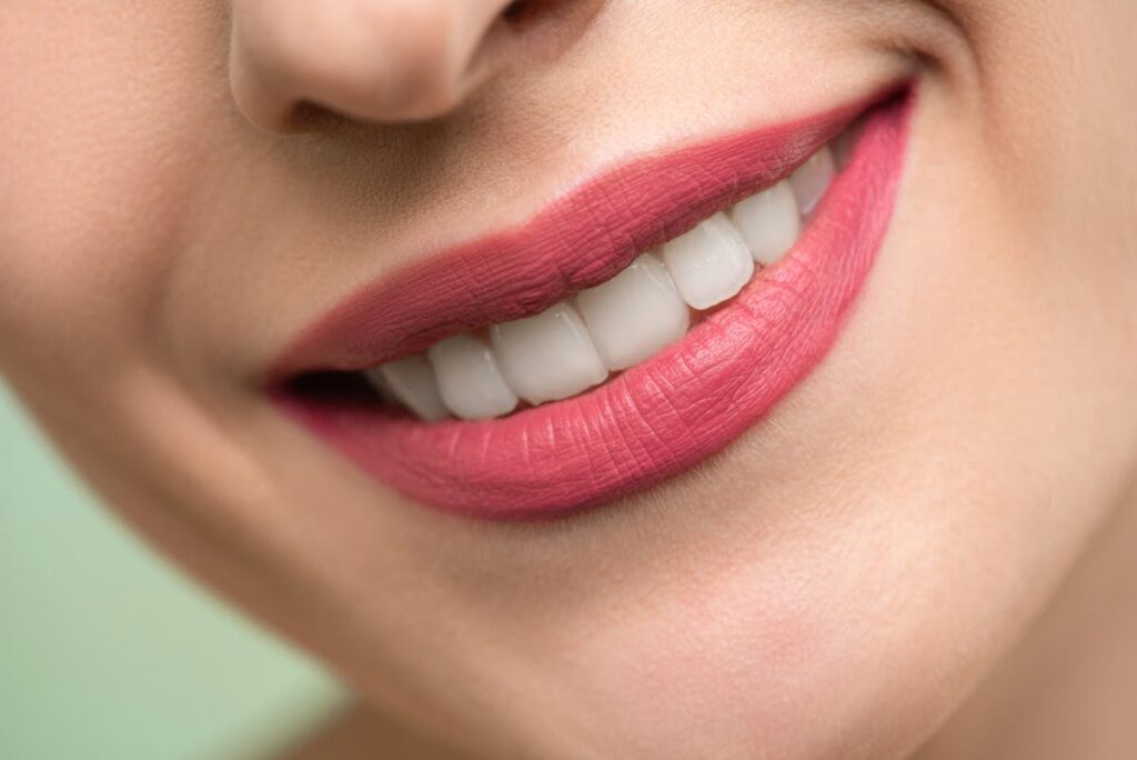 Beautiful smile after dental veneers treatment in Turkey